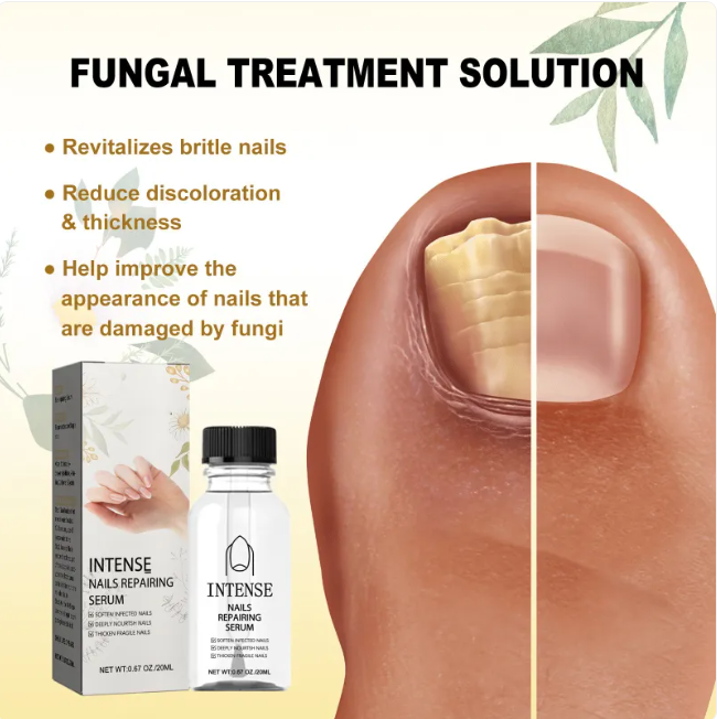 Soothing Steps Foot Treatment Kit