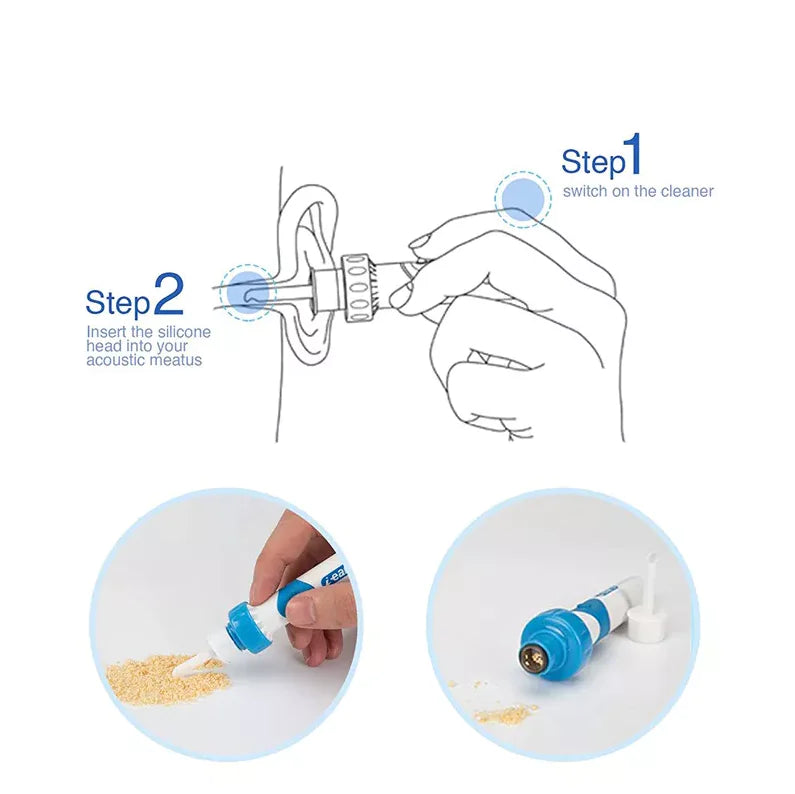 GentleVac Ear Wax Suction Tool
