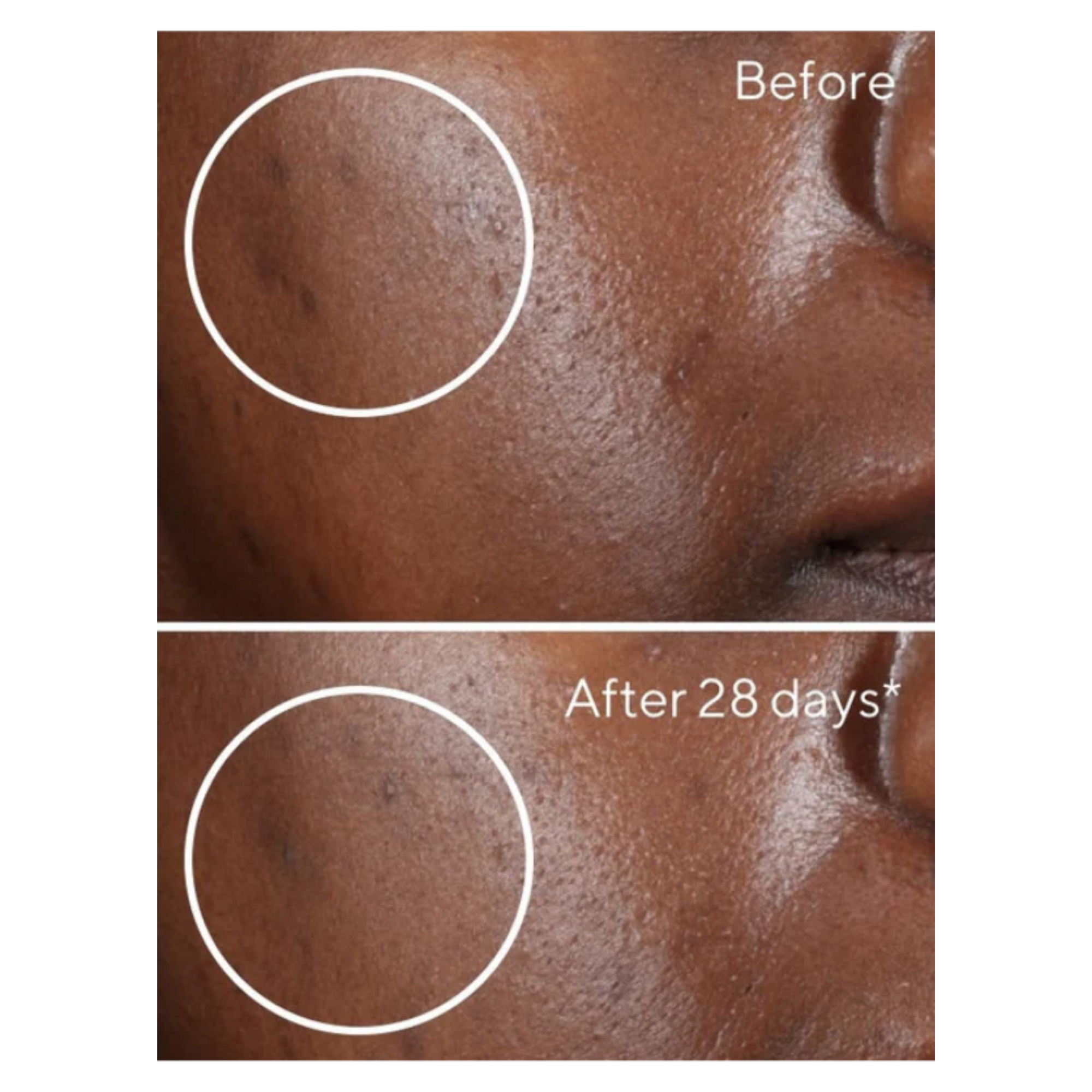 Glow Away Dark Spots