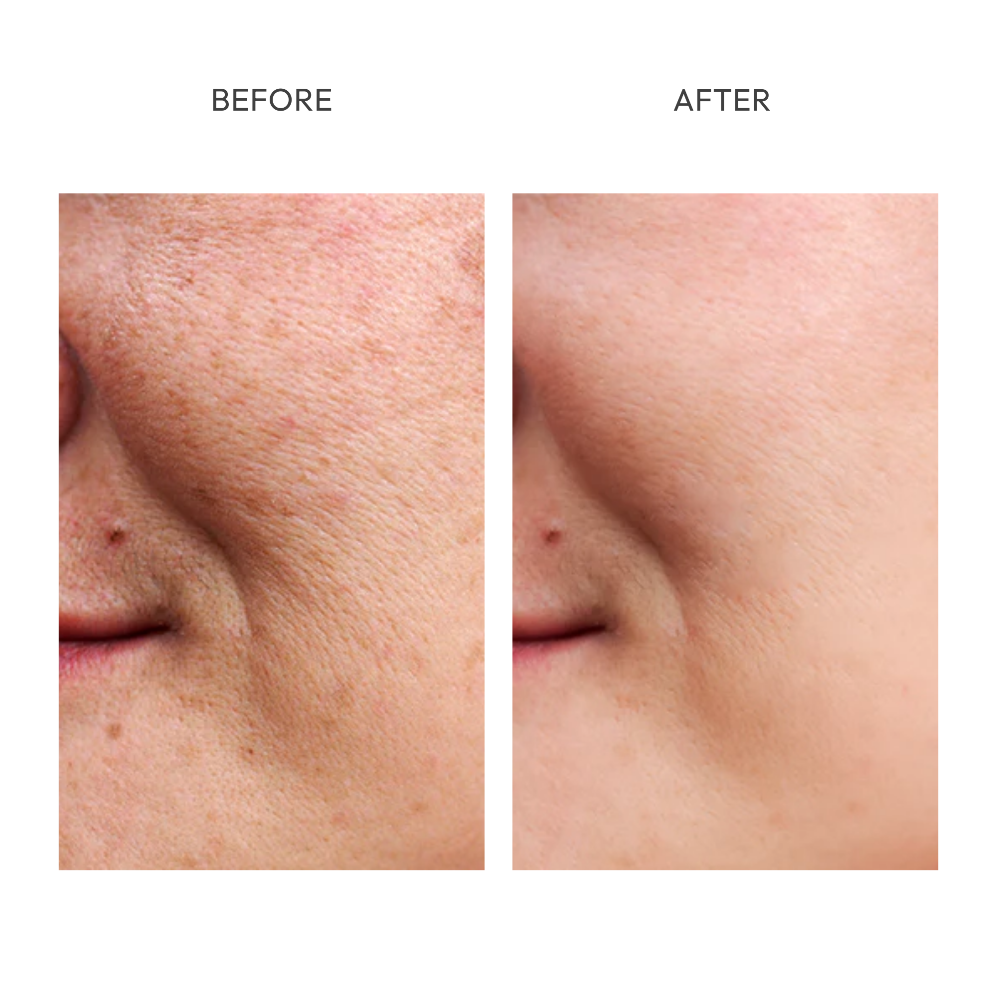Glow Away Dark Spots