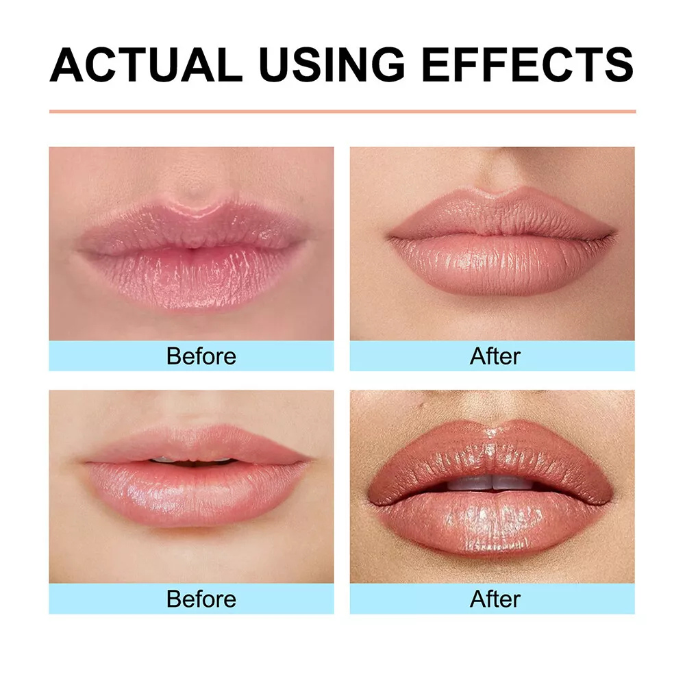 KissVault Lip Magic