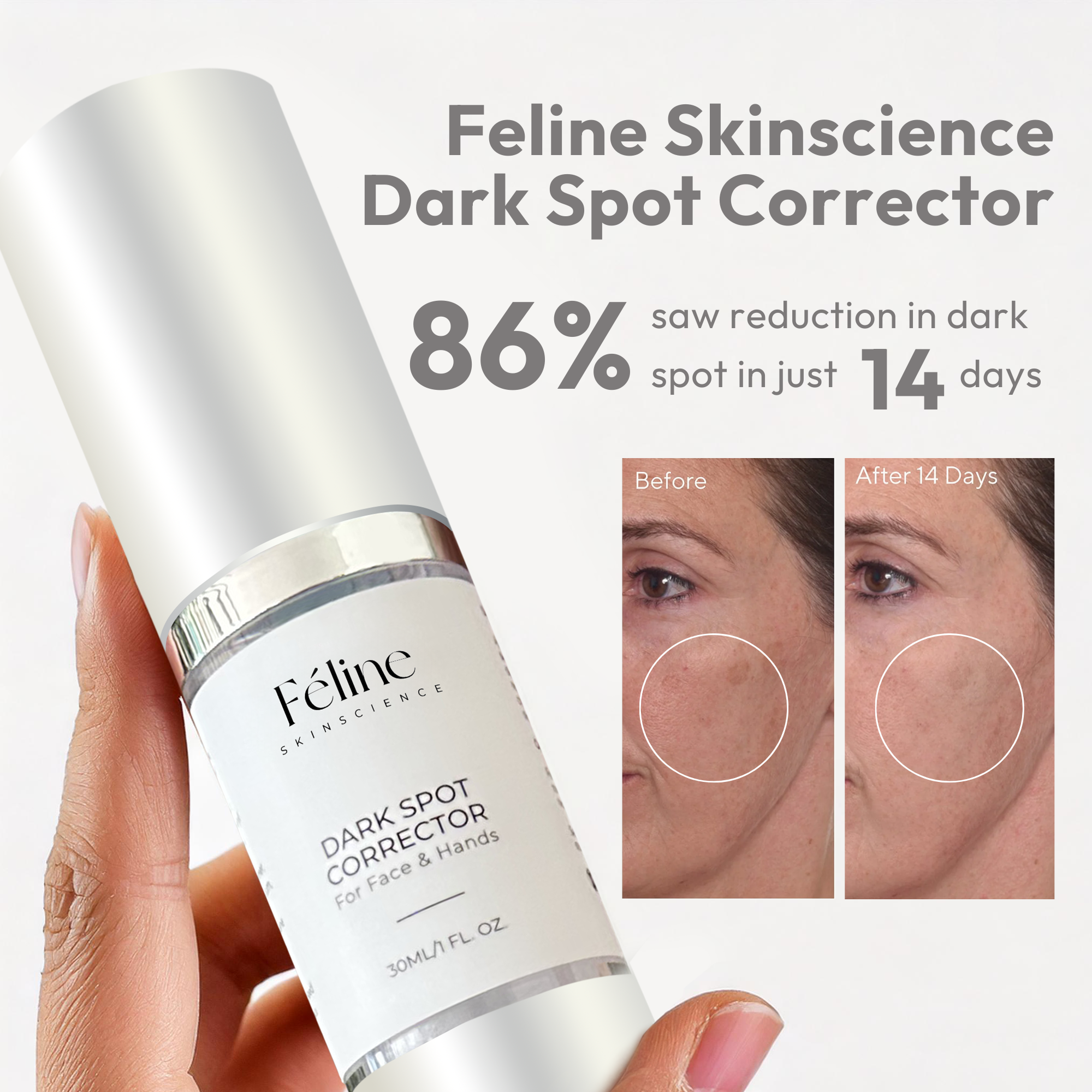 Glow Away Dark Spots