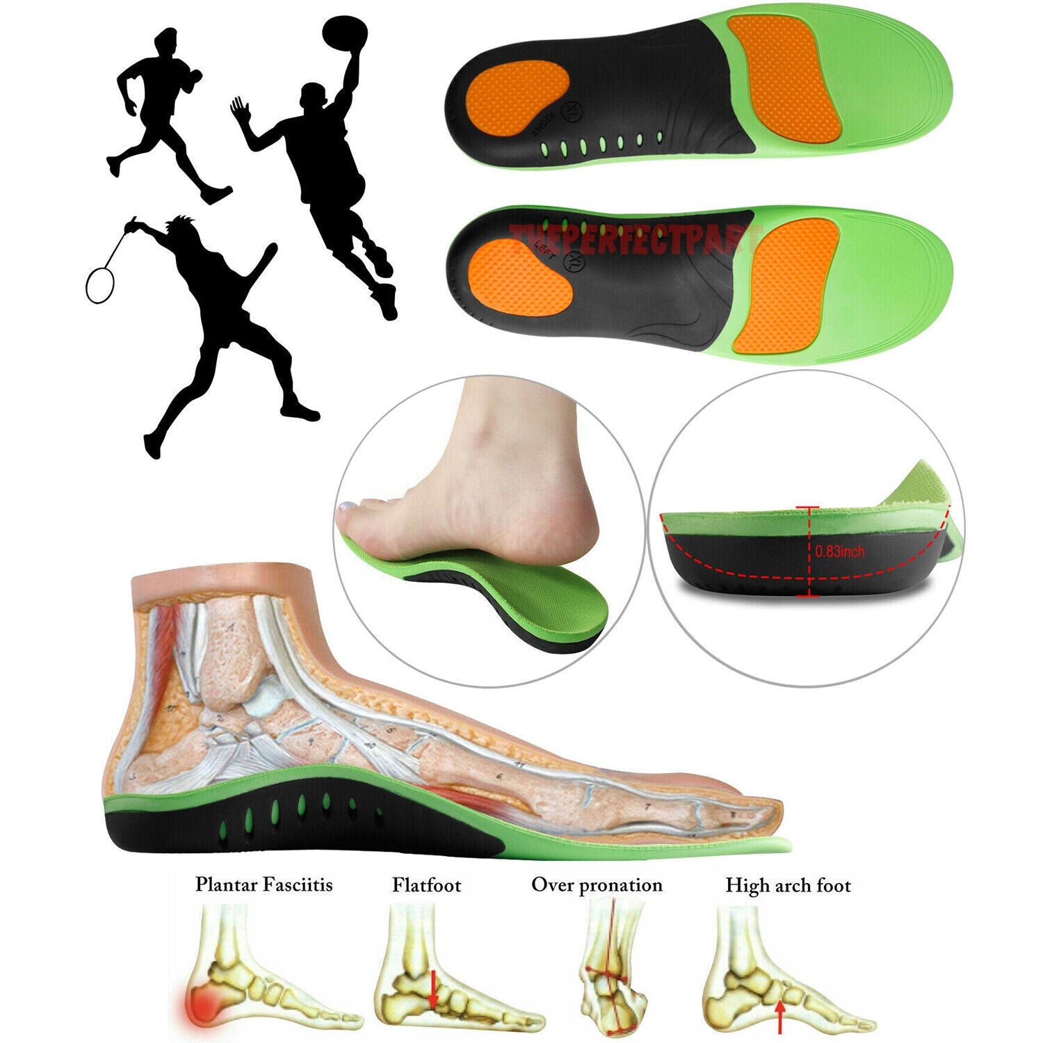 Targeted arch support orthotic insoles