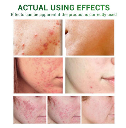 Scar Diminish &amp; Skin Enhance Oil