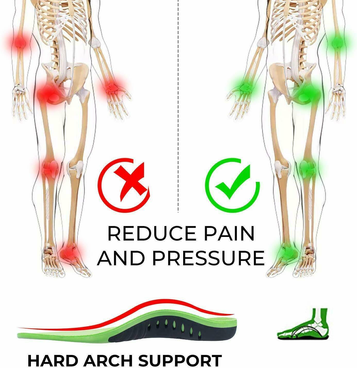Targeted arch support orthotic insoles