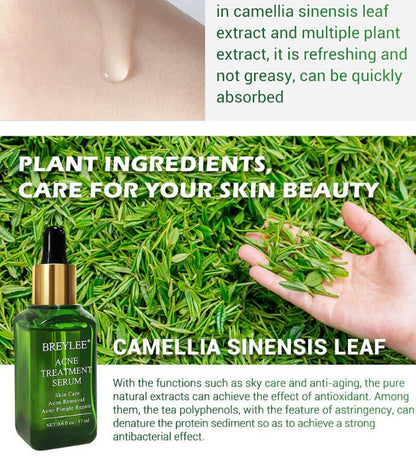 Scar Diminish &amp; Skin Enhance Oil