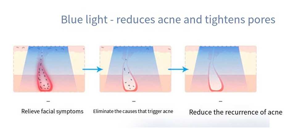 LED Radiance Therapy Mask
