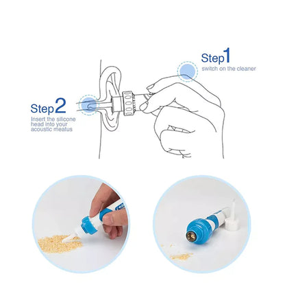 GentleVac Ear Wax Suction Tool
