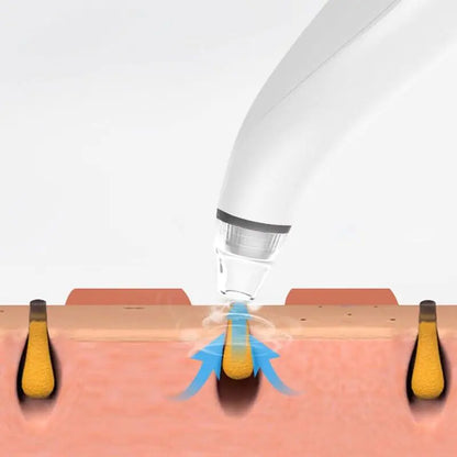 Diamond Pore Vacuum Cleaner