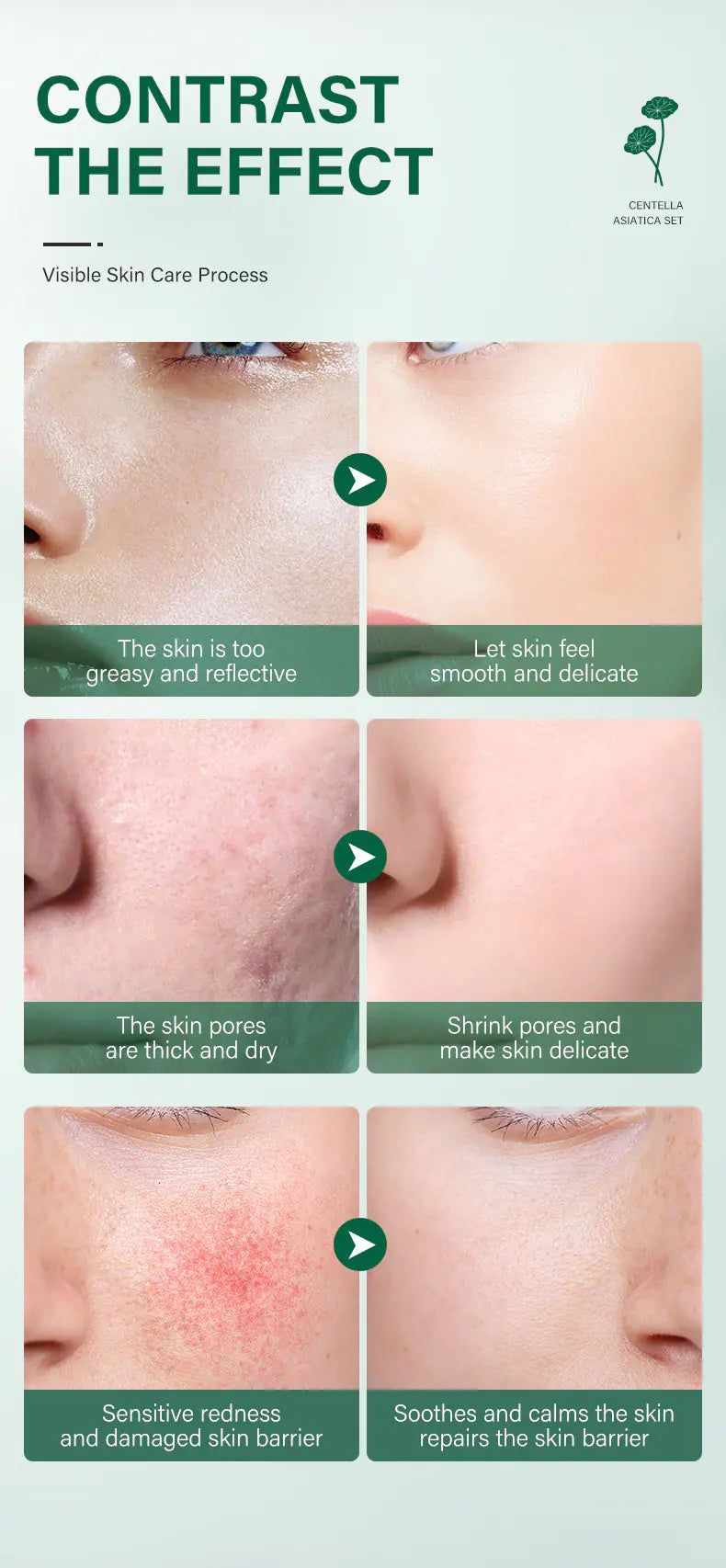 Centella Skin Soothing Repair Kit
