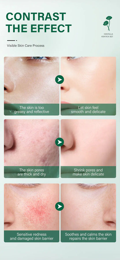 Centella Skin Soothing Repair Kit