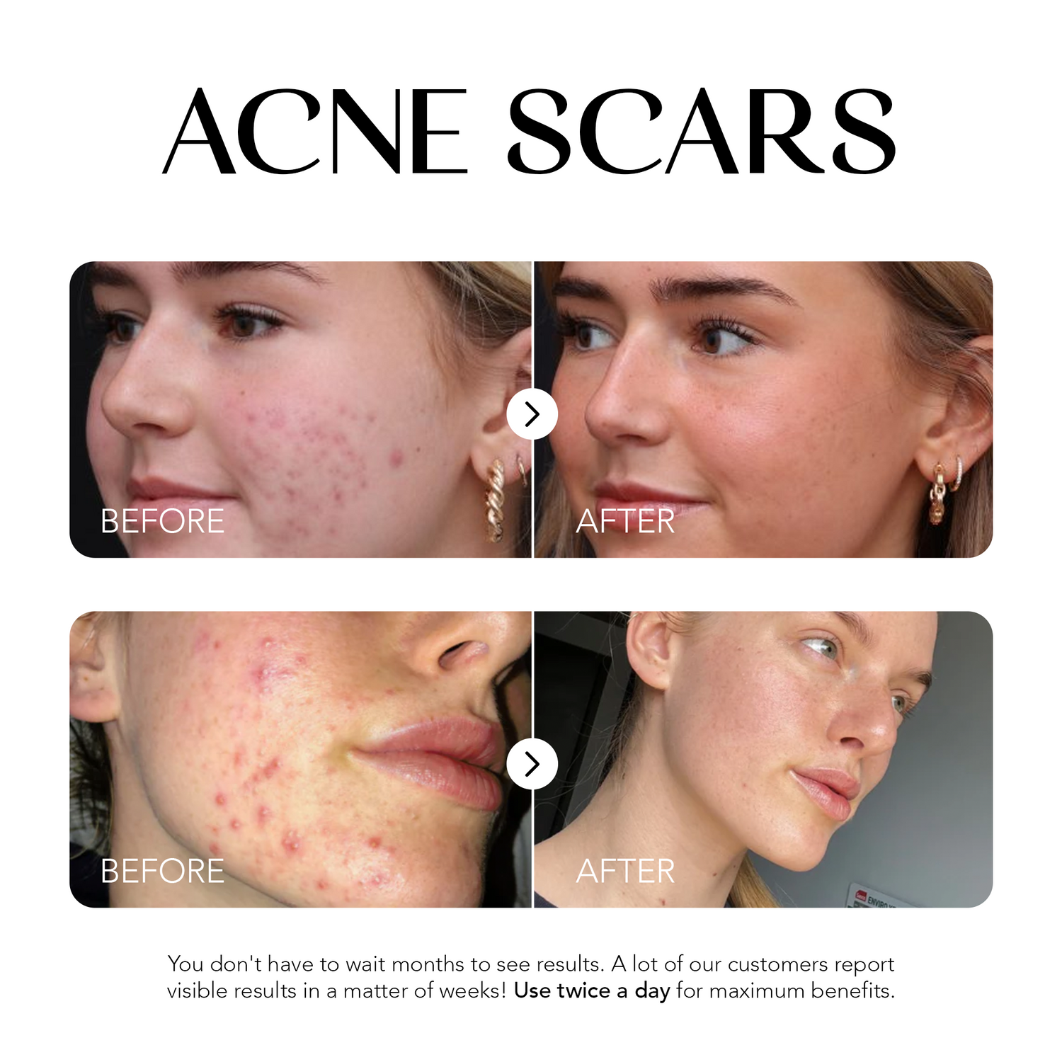 Glow Away Dark Spots