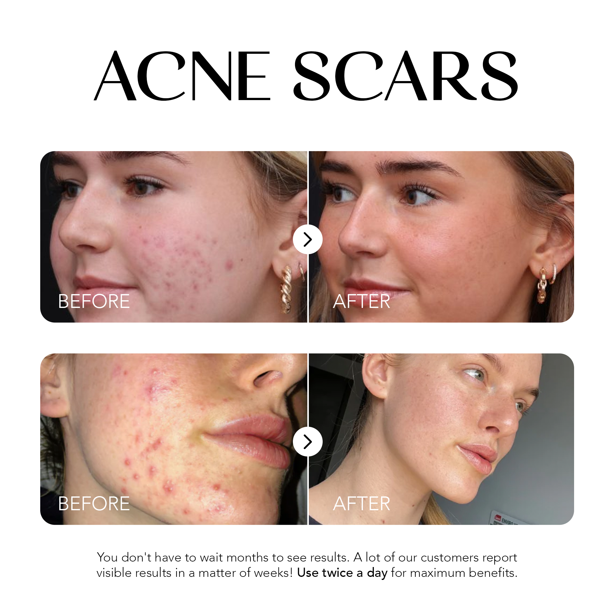 Glow Away Dark Spots