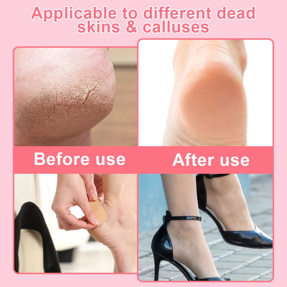 Smooth Steps Electric Callus Remover