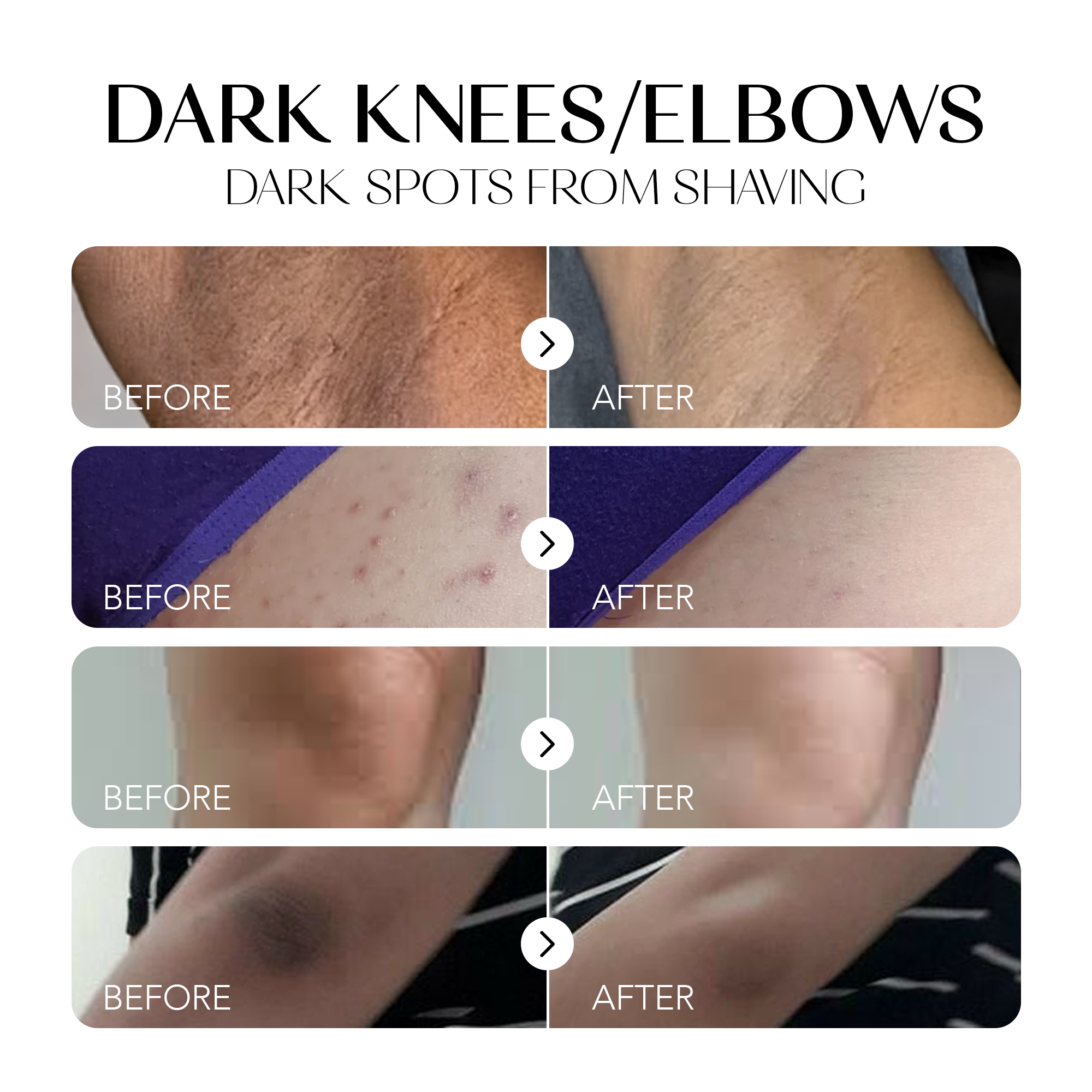 Glow Away Dark Spots