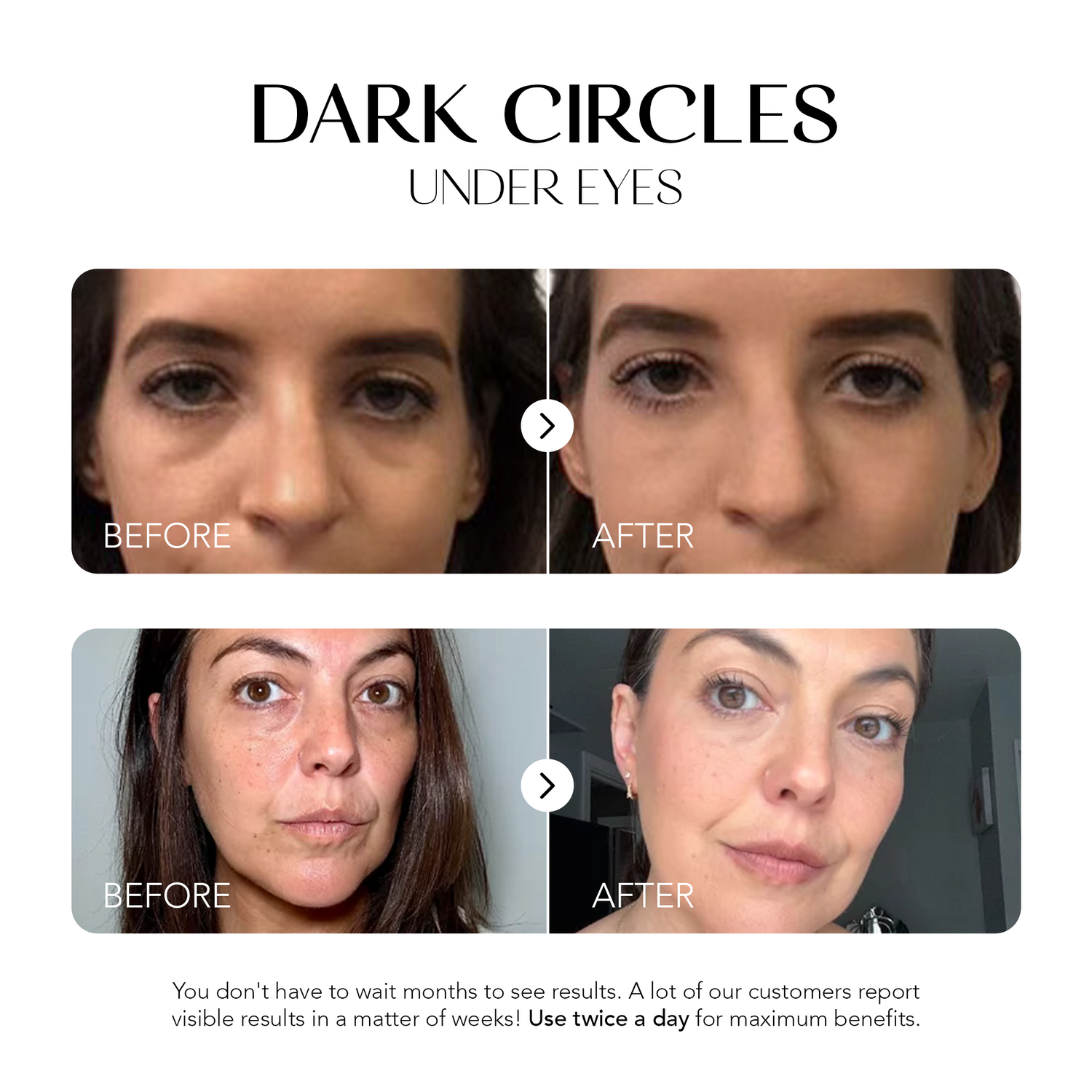 Glow Away Dark Spots