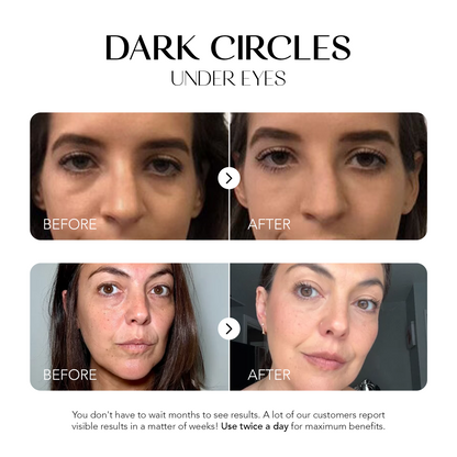 Glow Away Dark Spots