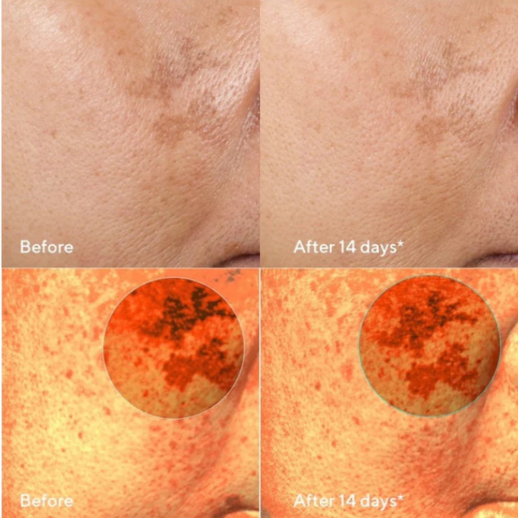 Glow Away Dark Spots