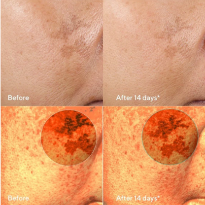 Glow Away Dark Spots
