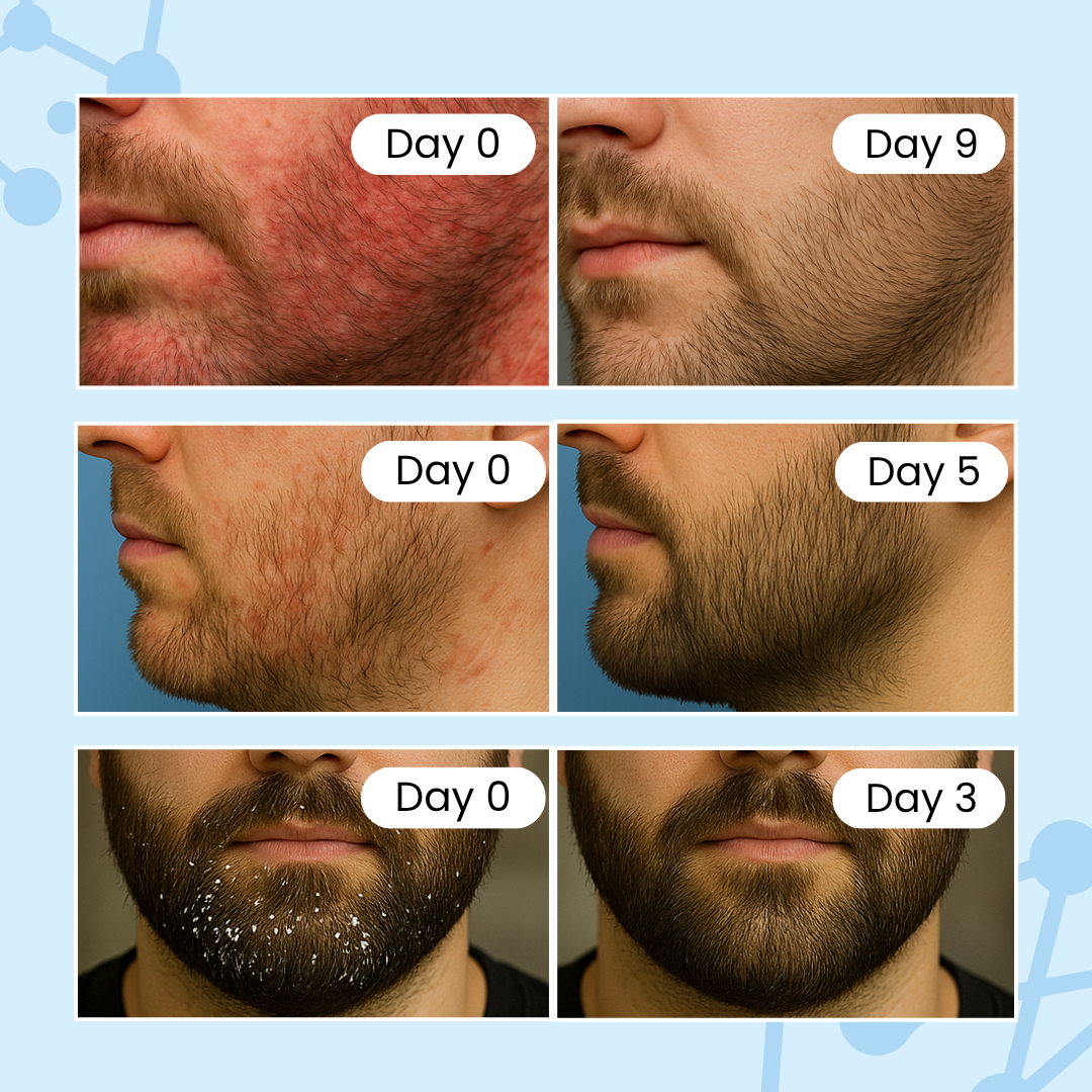 ClearSkin Beard Savior