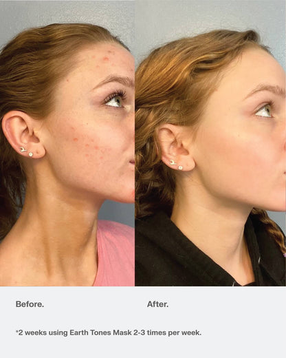 Glow Boost Face Mask