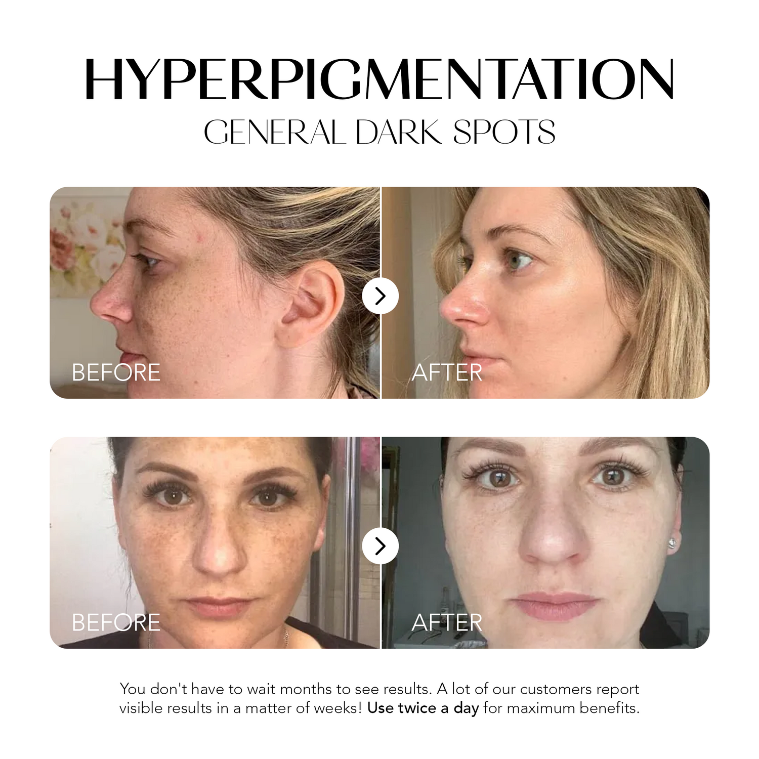 Glow Away Dark Spots