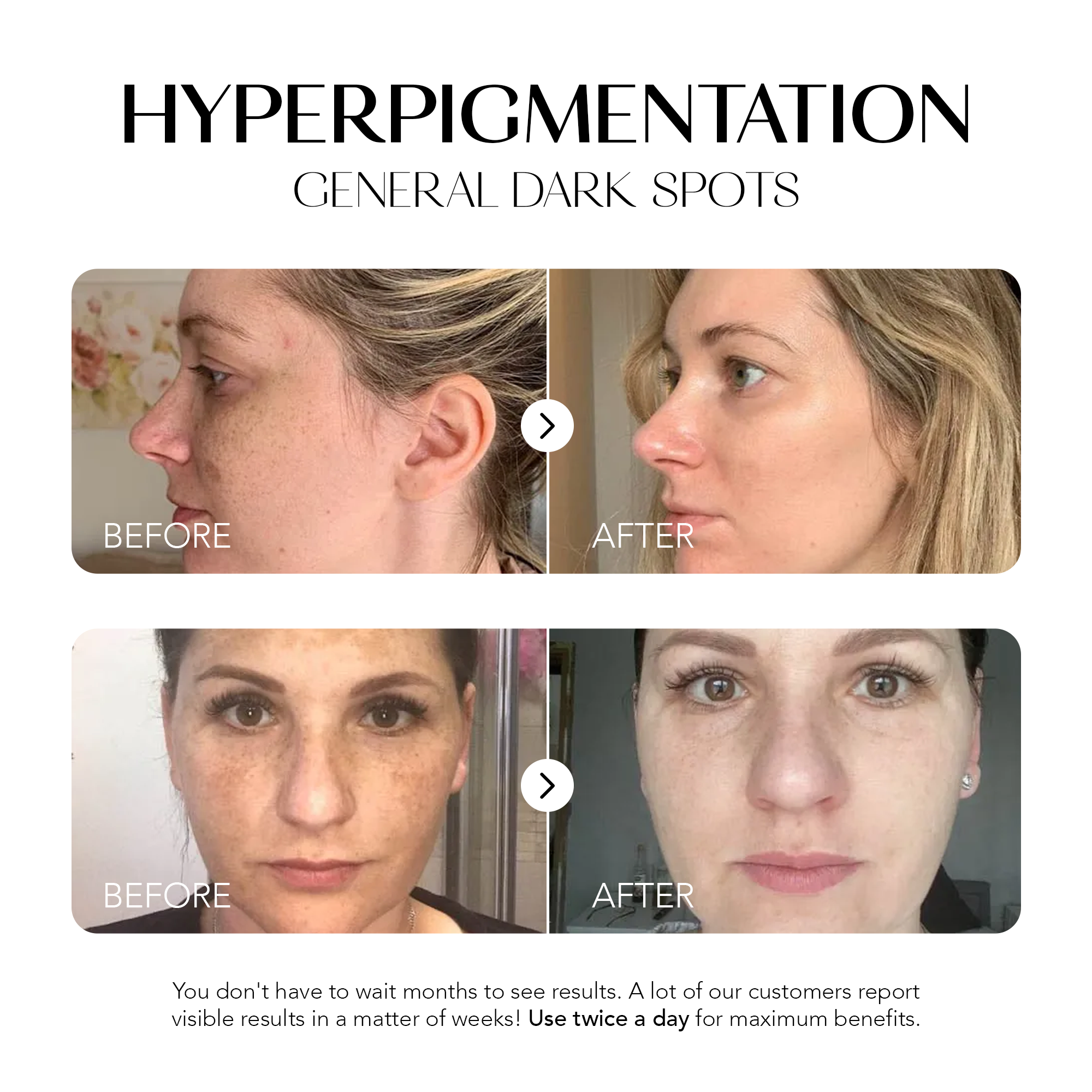 Glow Away Dark Spots