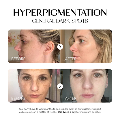 Glow Away Dark Spots