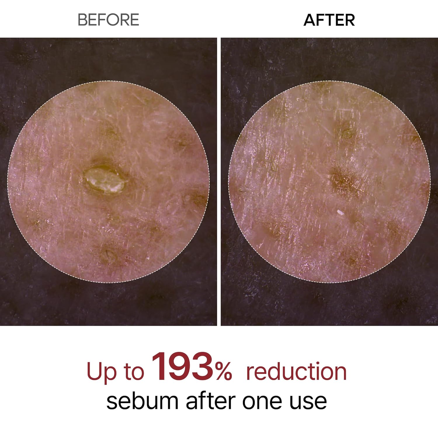 Radiant Skin Peeling Serum