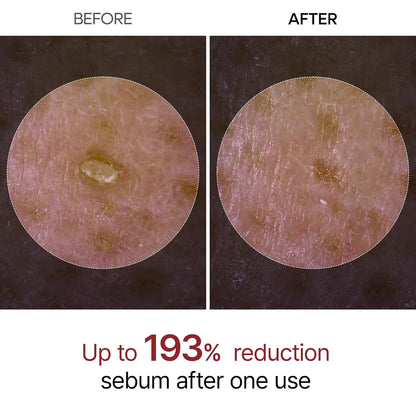 Radiant Skin Peeling Serum