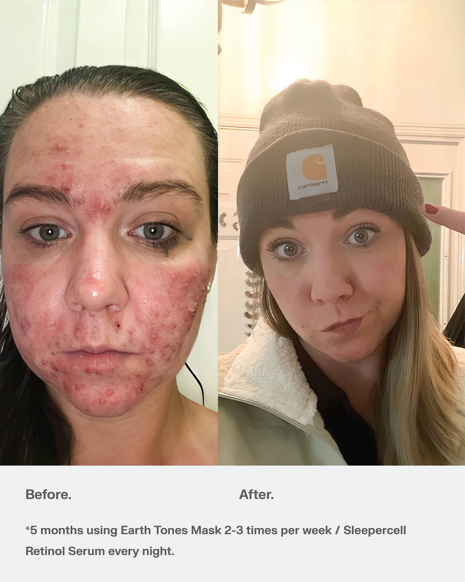 Glow Boost Face Mask