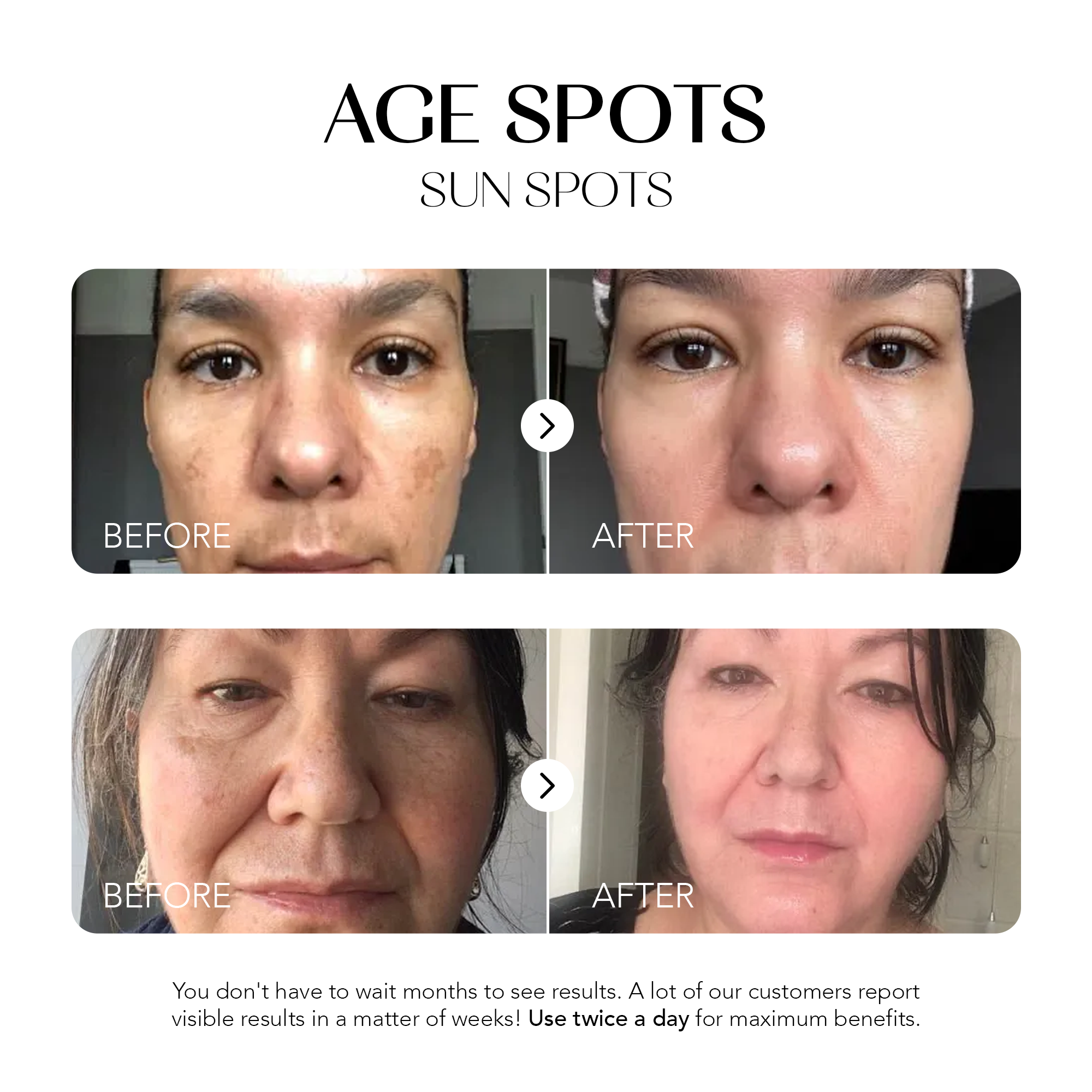 Glow Away Dark Spots