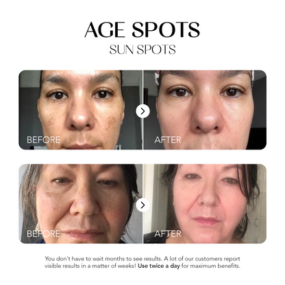 Glow Away Dark Spots