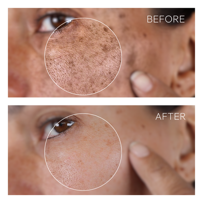 Glow Away Dark Spots