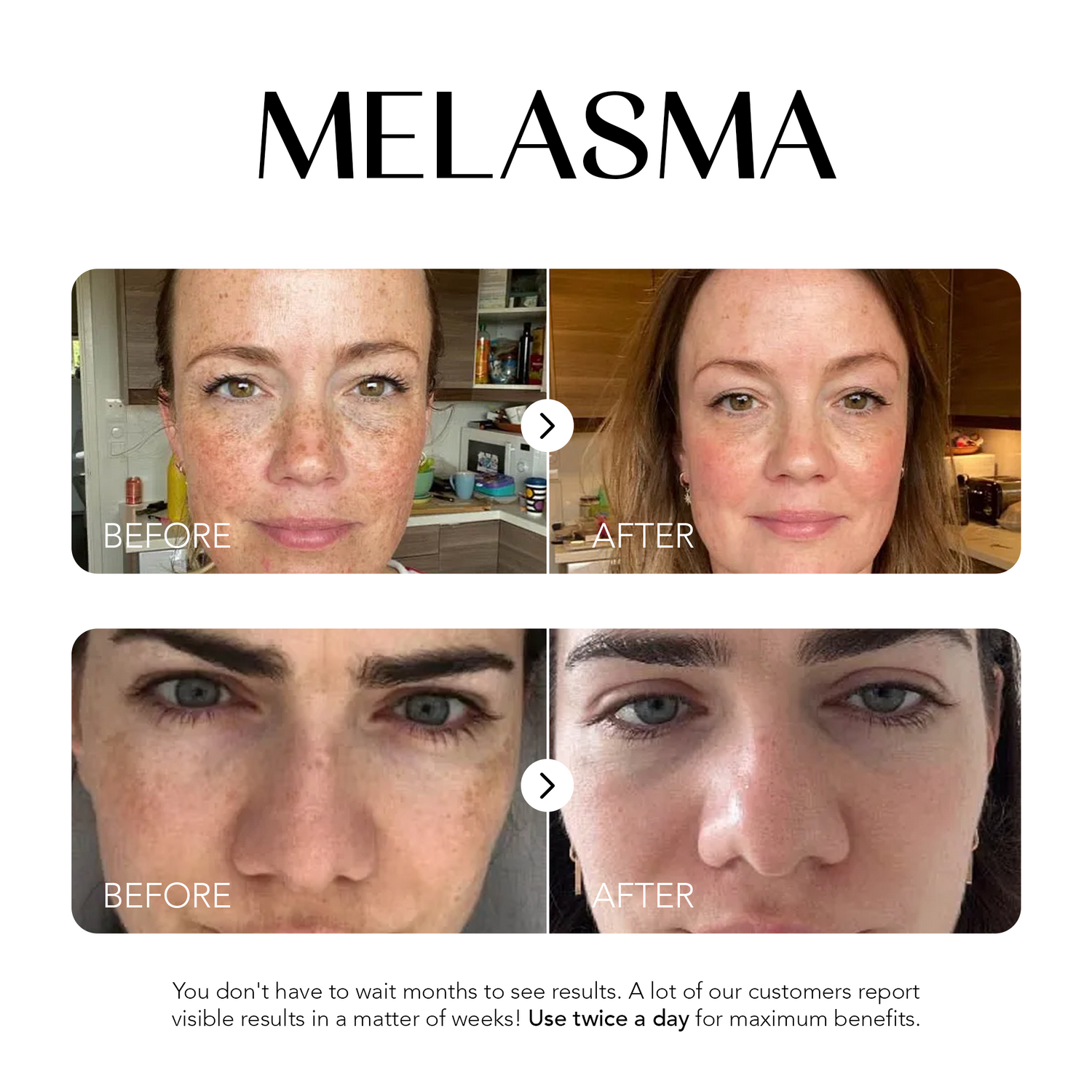Glow Away Dark Spots