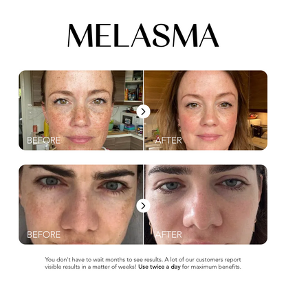 Glow Away Dark Spots