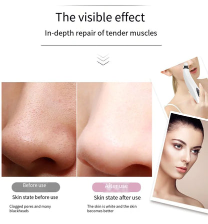 Diamond Pore Vacuum Cleaner