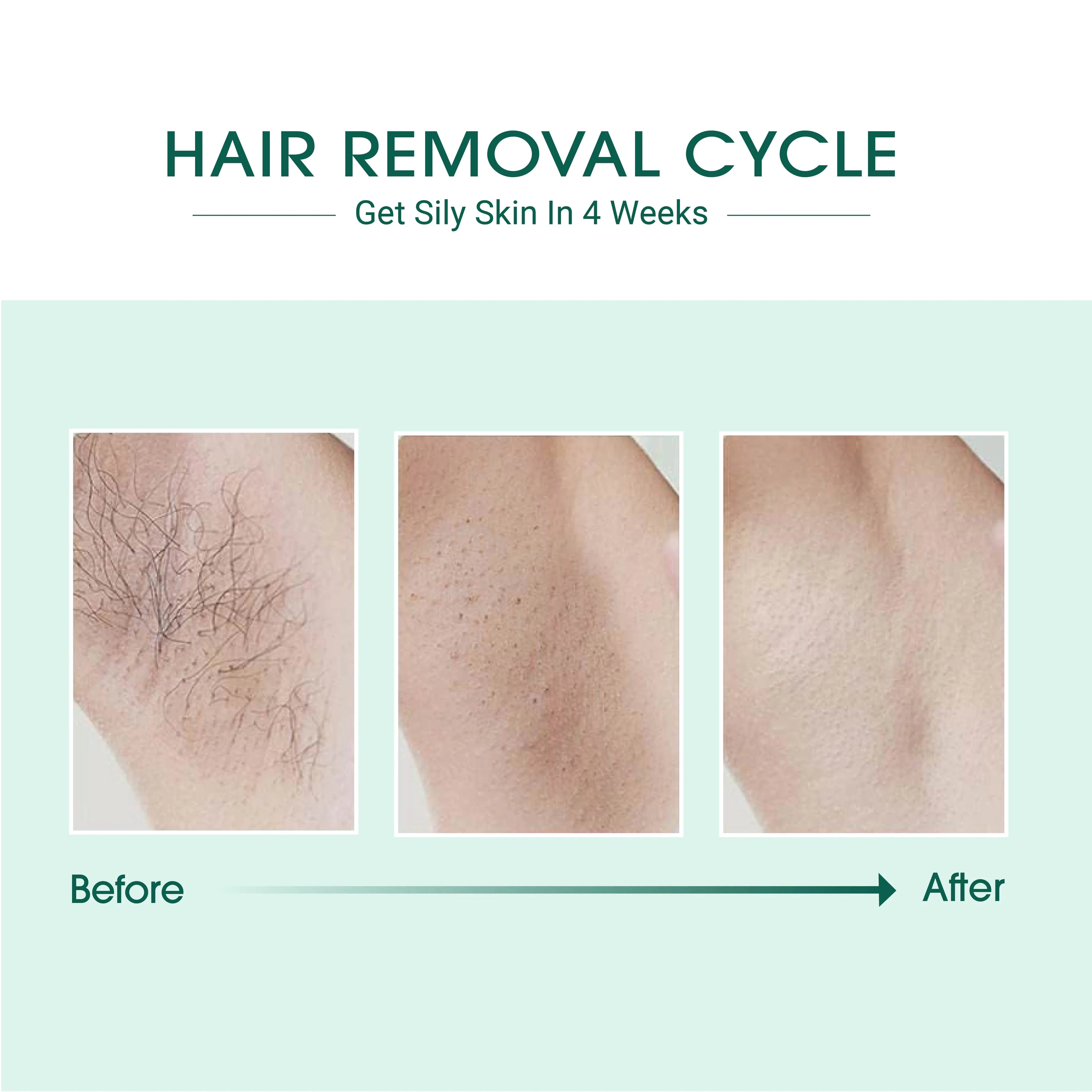 Silky Smooth IPL Hair Remover