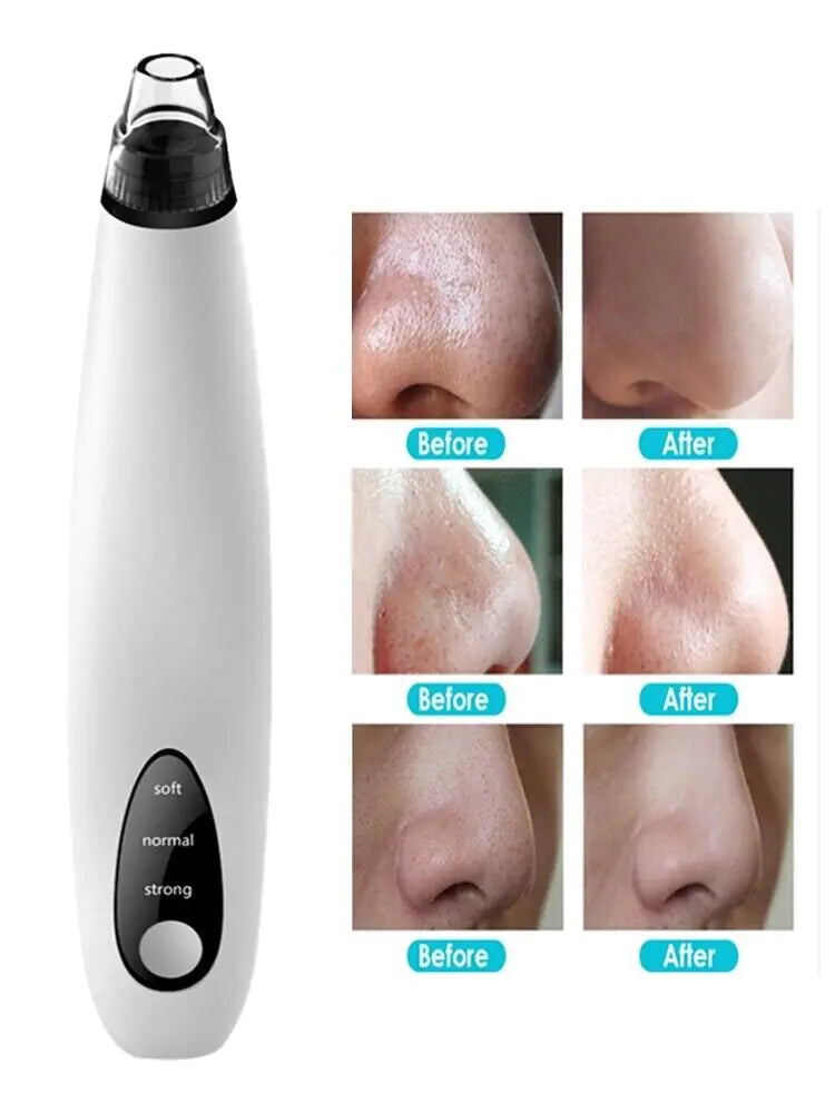 Diamond Pore Vacuum Cleaner