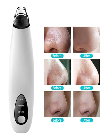 Diamond Pore Vacuum Cleaner